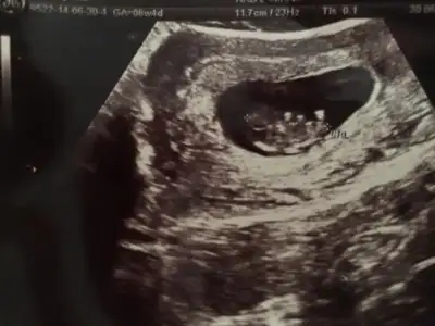 $ImageUploadedByKadÃÂ±nlar KuluÃËbuÃË1404221252.801630.webp