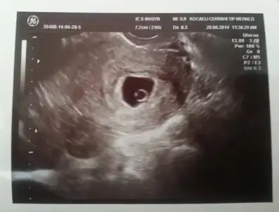 $Screen shot 2014-07-02 at 4.10.53 PM.webp