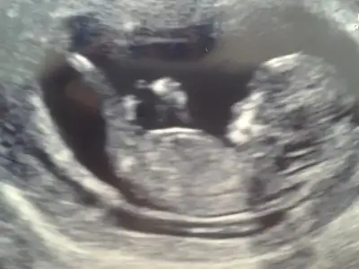 $2014-07-04 10.11.28.webp