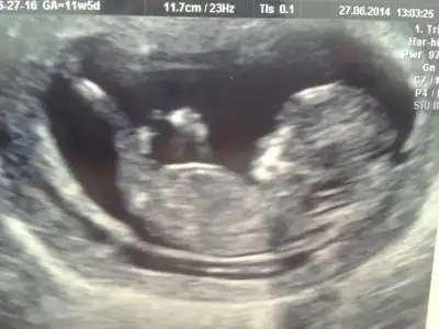 $2014-07-04 10.11.39.webp