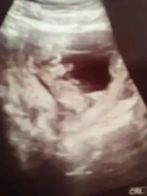 $ImageUploadedByKadÃÂ±nlar KuluÃËbuÃË1404559509.743261.webp