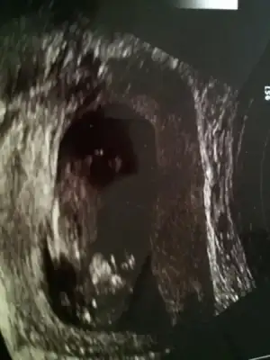 $ImageUploadedByKadÃÂ±nlar KuluÃËbuÃË1404576699.204178.webp