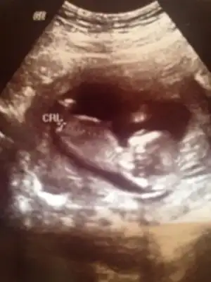 $ImageUploadedByKadÃÂ±nlar KuluÃËbuÃË1404655907.749003.webp