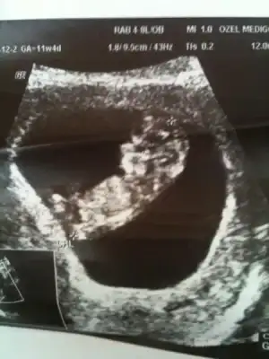 $ImageUploadedByKadÃÂ±nlar KuluÃËbuÃË1404743018.879411.webp