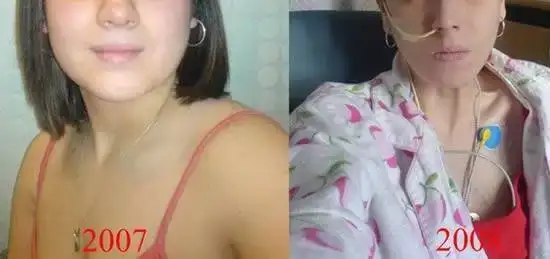 $ac_kalarak_zayiflama.webp $ac_kalarak_zayiflama.webp
