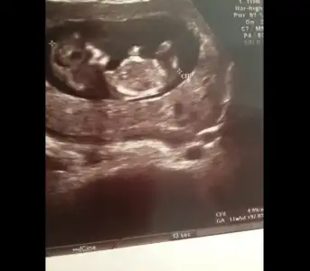 $ImageUploadedByKadÃÂ±nlar KuluÃËbuÃË1405538293.520394.webp