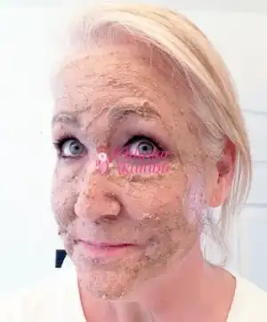 $peeling_maskesi_4.webp