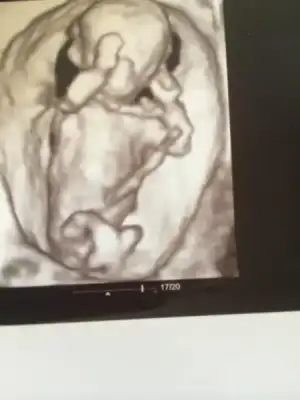 $ImageUploadedByKadÃÂ±nlar KuluÃËbuÃË1406108382.660393.webp