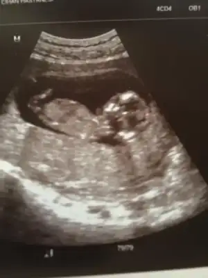 $ImageUploadedByKadÃÂ±nlar KuluÃËbuÃË1406108404.204793.webp