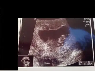 $10+1 - 10+3 (2) - Kopya.webp