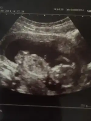 $ImageUploadedByKadÃÂ±nlar KuluÃËbuÃË1407264197.981551.webp