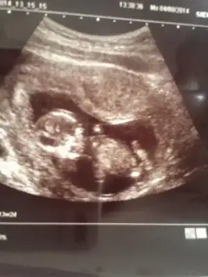 $ImageUploadedByKadÃÂ±nlar KuluÃËbuÃË1407264216.461981.webp