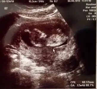 $ImageUploadedByKadÃÂ±nlar KuluÃËbuÃË1407344786.292295.webp