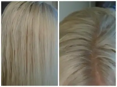 $saÃ§ kÃ¼llÃ¼ saÃ§Ã½m.webp