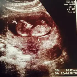 $ImageUploadedByKadÃÂ±nlar KuluÃËbuÃË1407573470.473045.webp