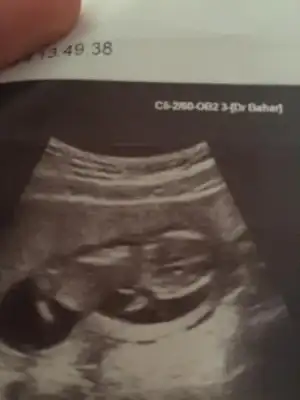 $ImageUploadedByKadÃÂ±nlar KuluÃËbuÃË1407611957.680755.webp