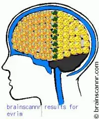 $brainscannr.webp
