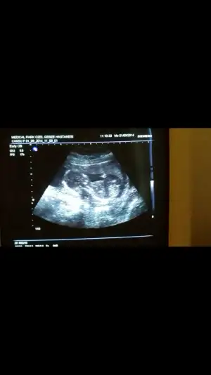 Screenshot_2014-09-18-10-18-30.webp