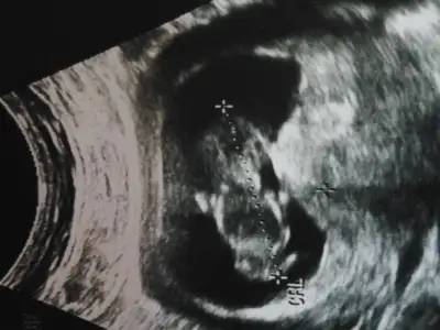 2014-10-01 20.42.18.webp