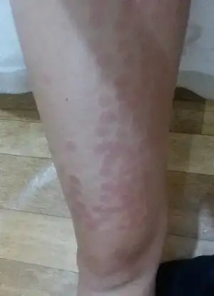 medicana resim.webp