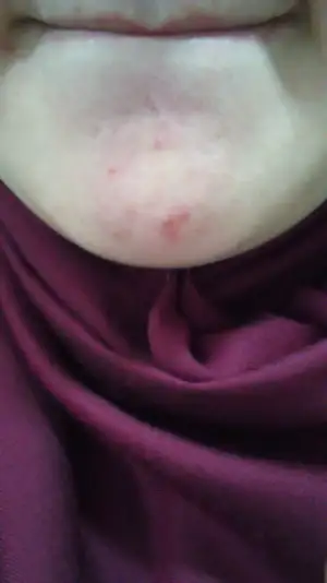 IMAG0161.webp