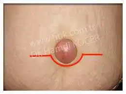 images.webp