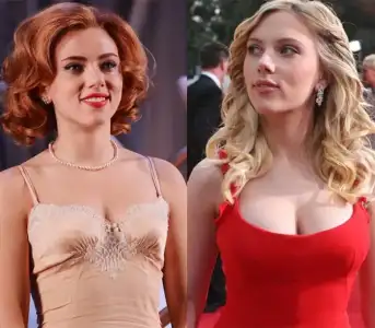 scarlett-johansson-breast-reduction.webp