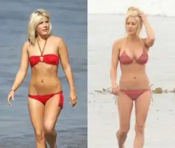 shayne-lamas-plastic-surgery-breast-implants.webp