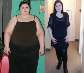 before and after weight loss5.webp