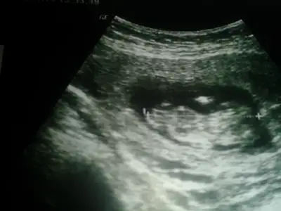 2014-11-26 13.26.01.webp