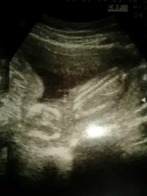 2014-12-01 16.08.18.webp