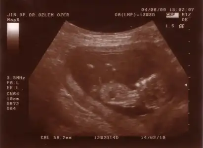 $Untitled-1 copy.webp