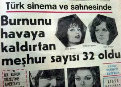 $eski_estetik_burun_buyuk[1].webp