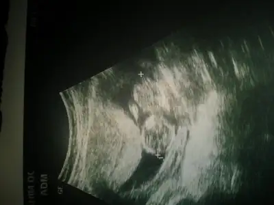 2014-12-08 10.48.49.webp