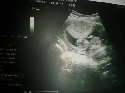 2014-12-08 10.54.52.webp