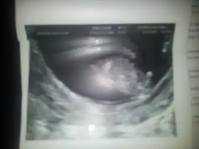 2014-12-14 19.55.22.webp