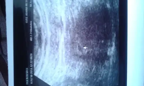 IMG-20141222-WA0003.webp