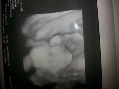 20141229_143530.webp