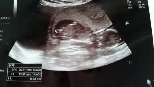 2015-01-05 08.58.16.webp