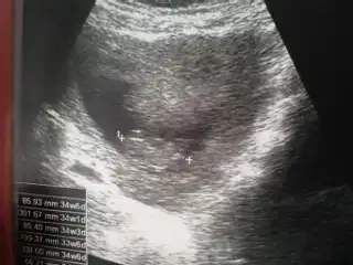 2015-01-10 10.05.24.webp