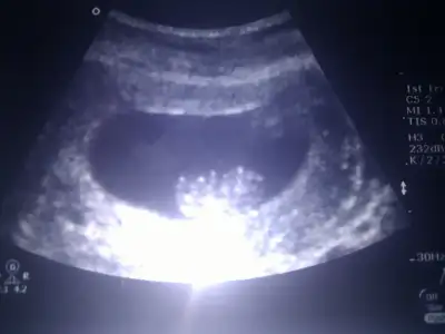 $img20110630204023.webp $img20110630204023.webp