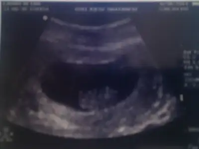 $img20110630204037.webp $img20110630204037.webp