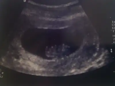 $img20110630204049.webp $img20110630204049.webp