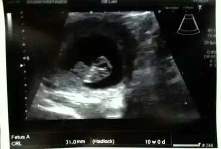 2015-01-18 15.51.59.webp