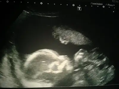 2015-01-24 10.51.01.webp