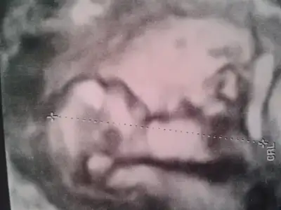 2015-01-27 15.14.47.webp