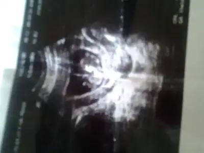 2015-02-05 11.07.27.webp