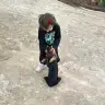 kombine estetik oldum