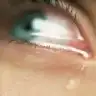 ozyes