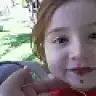 missclavicula